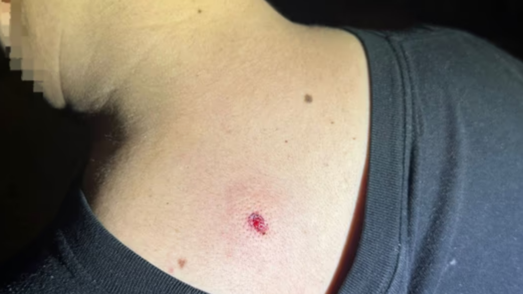 Disparaban balines en Nueva Córdoba, hirieron a un joven y terminaron detenidos